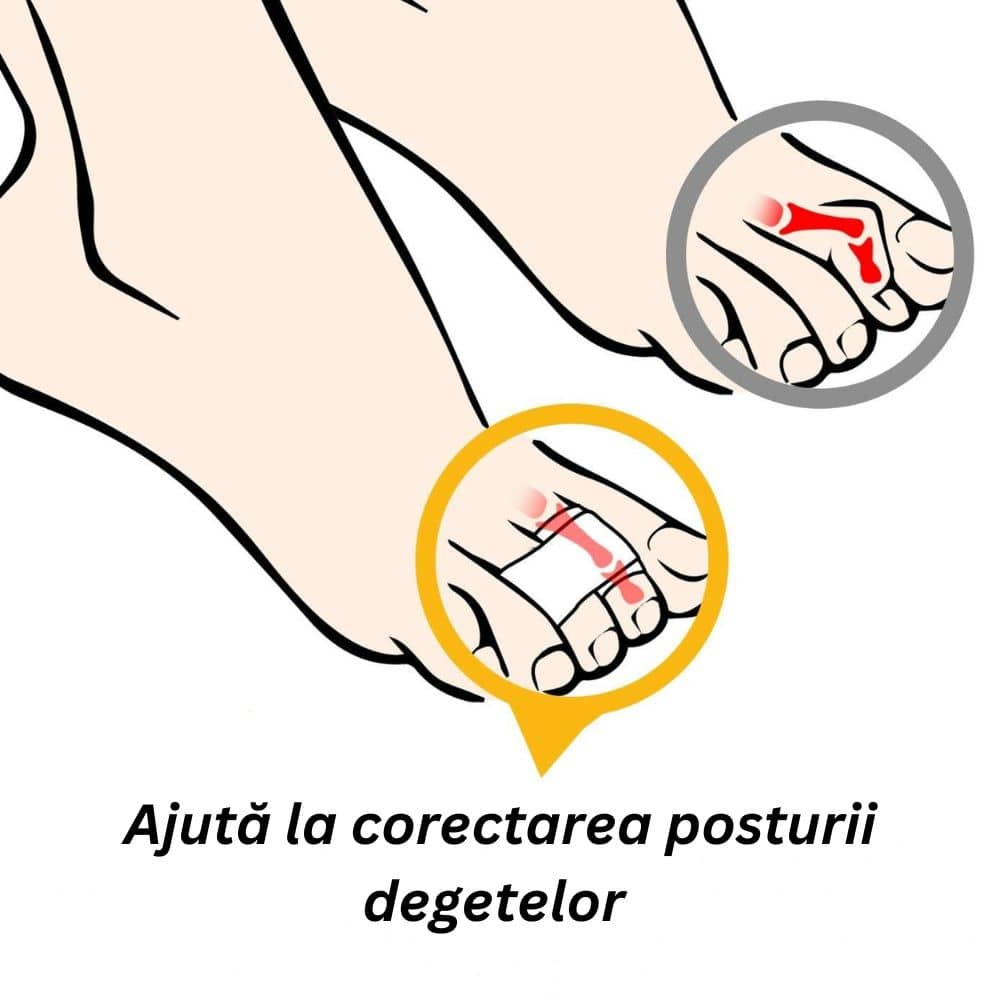 Set 5x Buc - Plasture Corector Degete